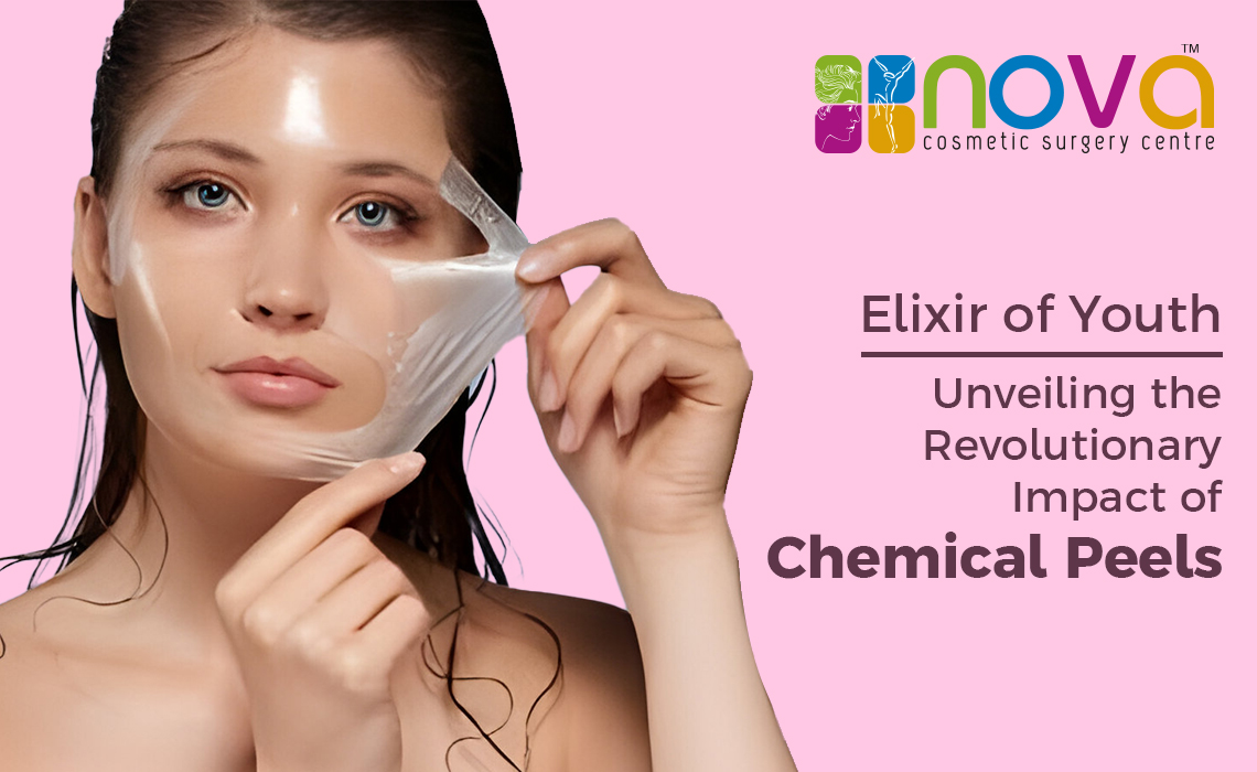 Elixir of Youth: Unveiling the Revolutionary Impact of Chemical Peels