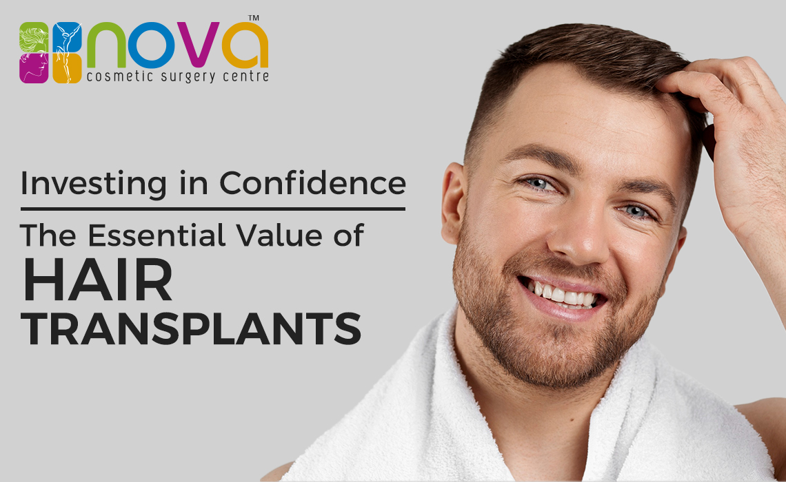 Investing in Confidence: The Essential Value of Hair Transplants