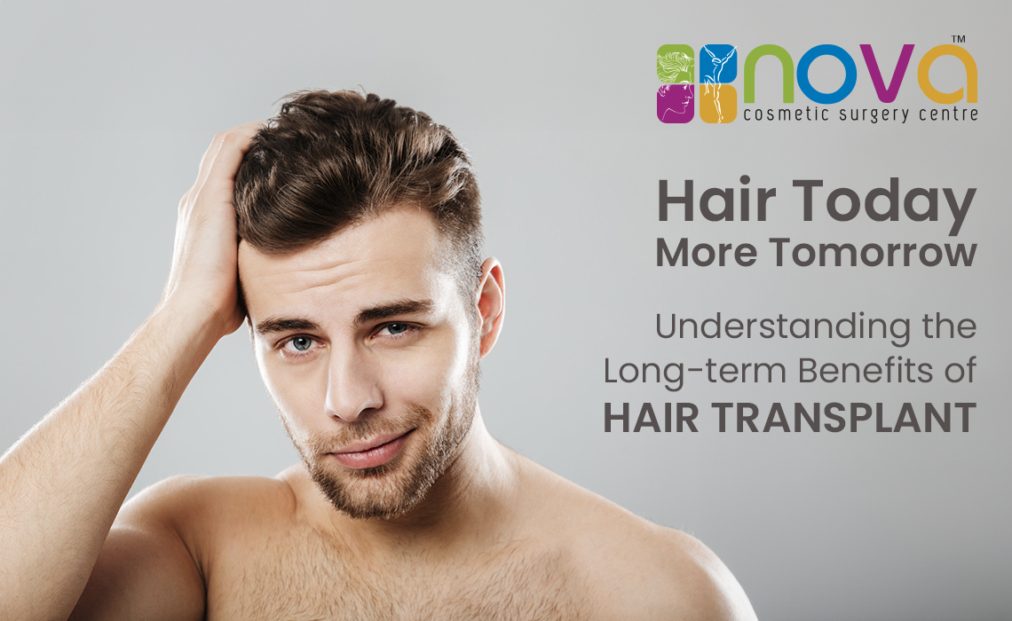 Hair today, more tomorrow: Understanding the Long-term Benefits of Hair Transplant