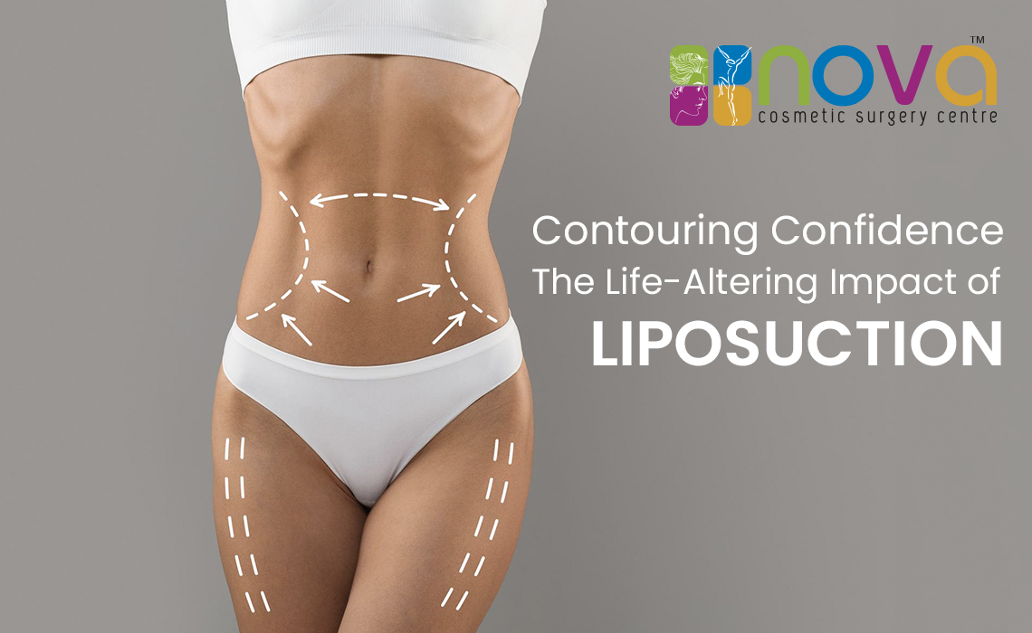Contouring Confidence: The Life-Altering Impact of Liposuction