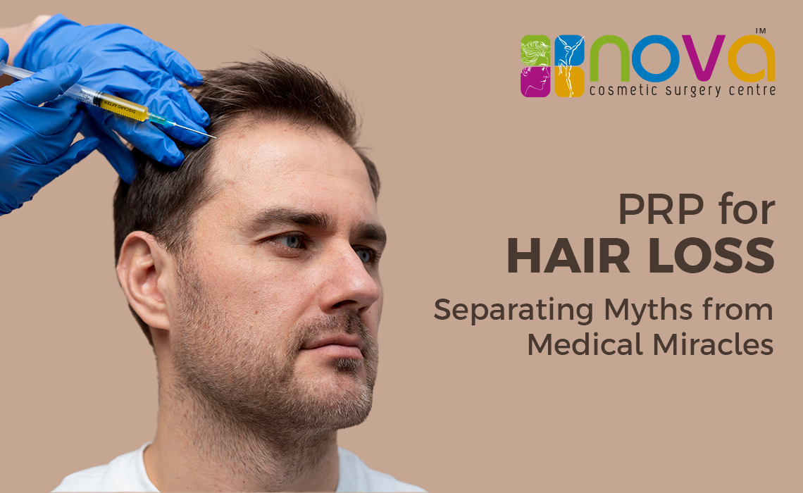 PRP for Hair Loss: Separating Myths from Medical Miracles