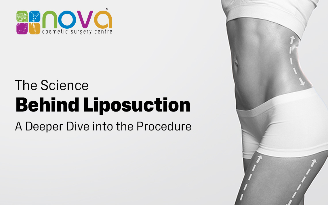 The Science Behind Liposuction: A Deeper Dive into the Procedure