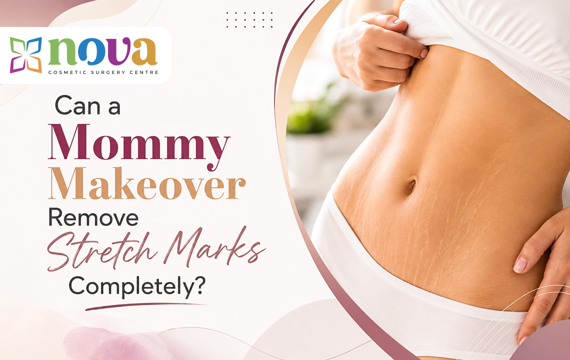 Can a Mommy Makeover Remove Stretch Marks Completely?