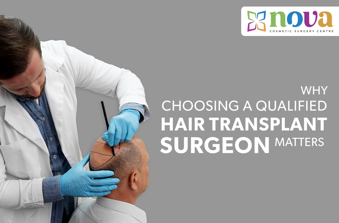 Why Choosing a Qualified Hair Transplant Surgeon Matters