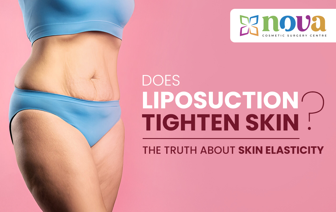 Does Liposuction Tighten Skin? The Truth About Skin Elasticity