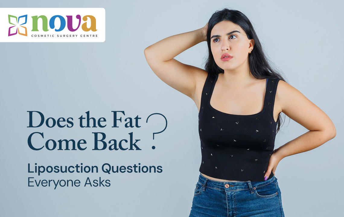 Does the Fat Come Back? Liposuction Questions Everyone Asks