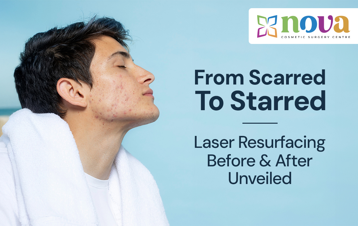 From Scarred To Starred: Laser Resurfacing Before & After Unveiled