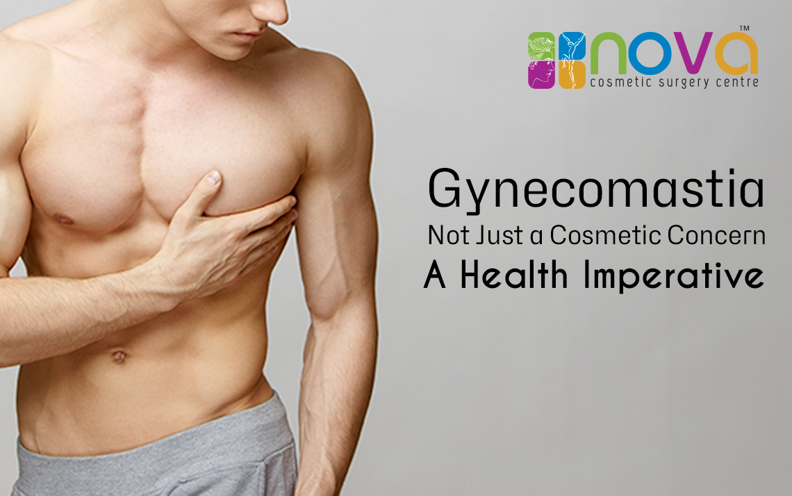 Gynecomastia: Not Just a Cosmetic Concern, A Health Imperative