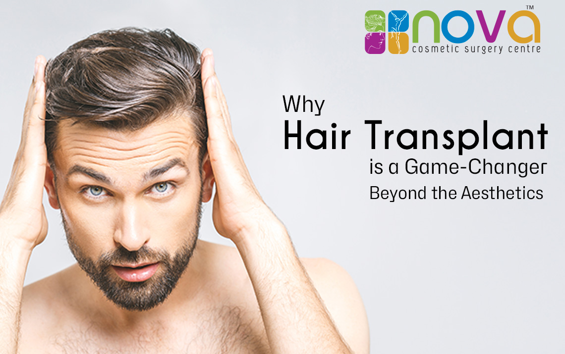 Why Hair Transplant is a Game-Changer: Beyond the Aesthetics