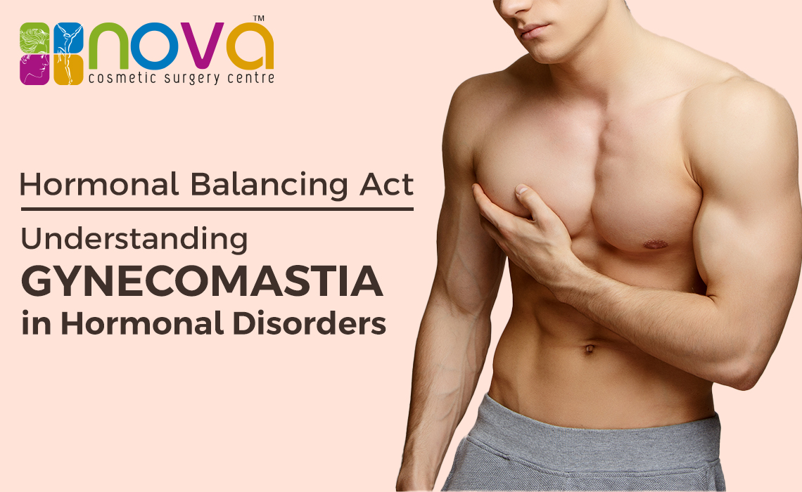 Hormonal Balancing Act: Understanding Gynecomastia in Hormonal Disorders