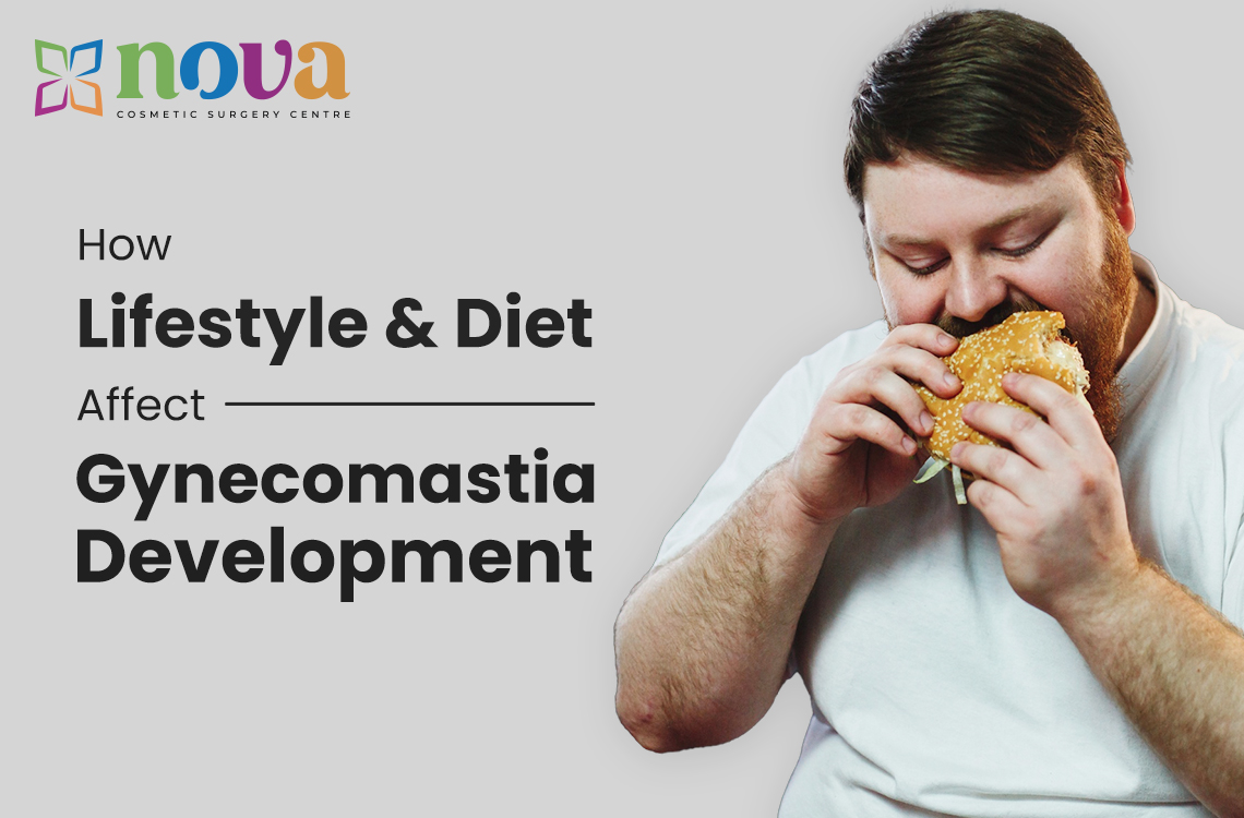 How Lifestyle & Diet Affect Gynecomastia Development