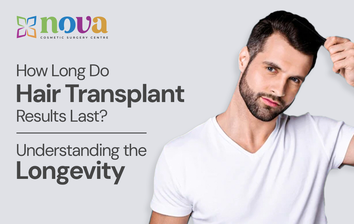 How Long Do Hair Transplant Results Last? Understanding the Longevity