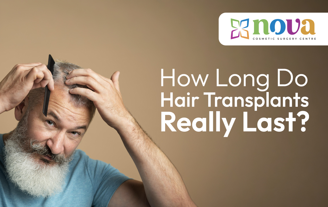 How Long Do Hair Transplants Really Last?