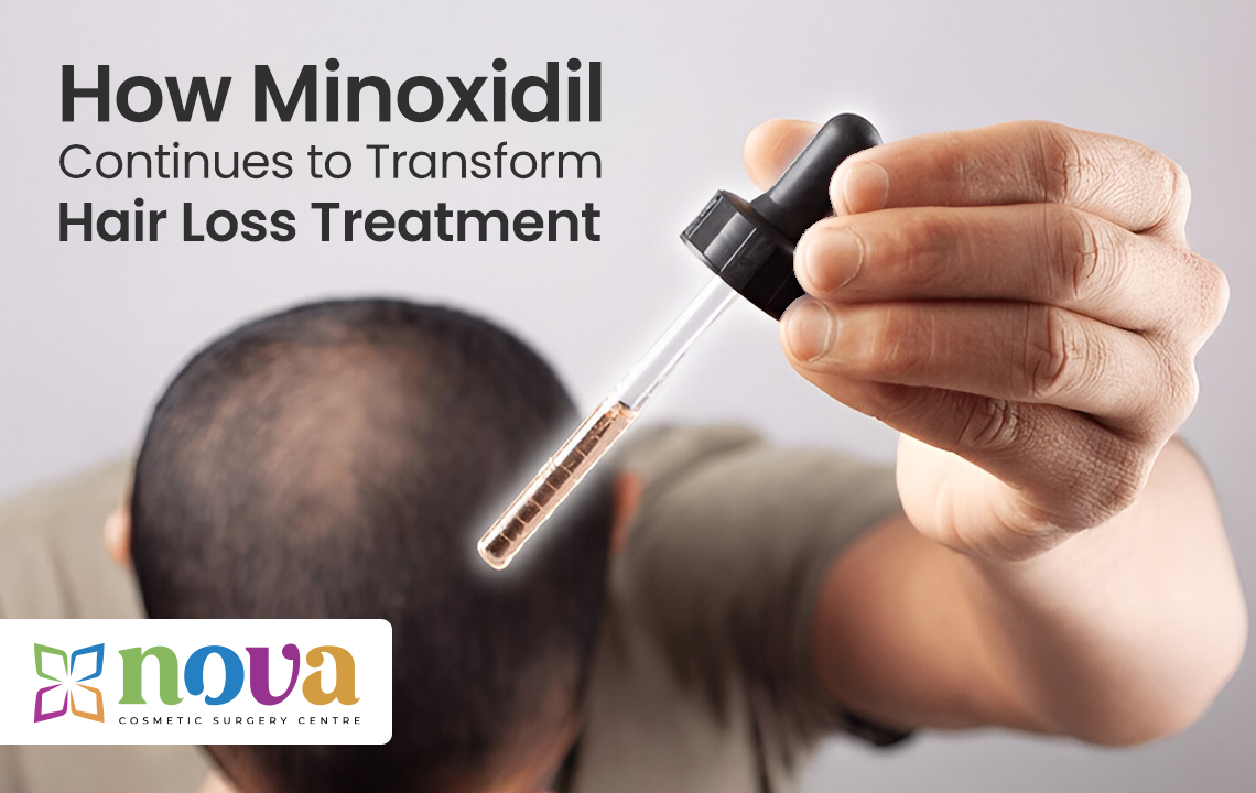 How Minoxidil Continues to Transform Hair Loss Treatment
