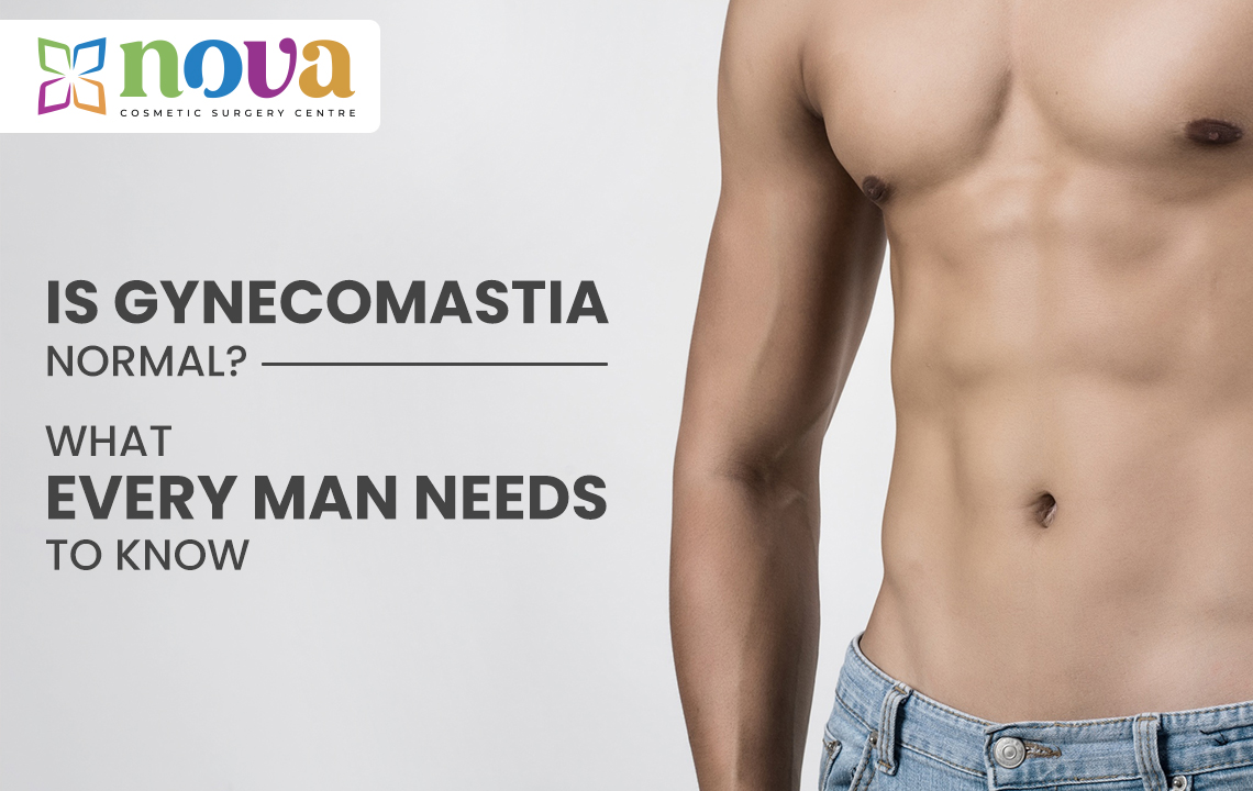 Is Gynecomastia Normal? What Every Man Needs to Know