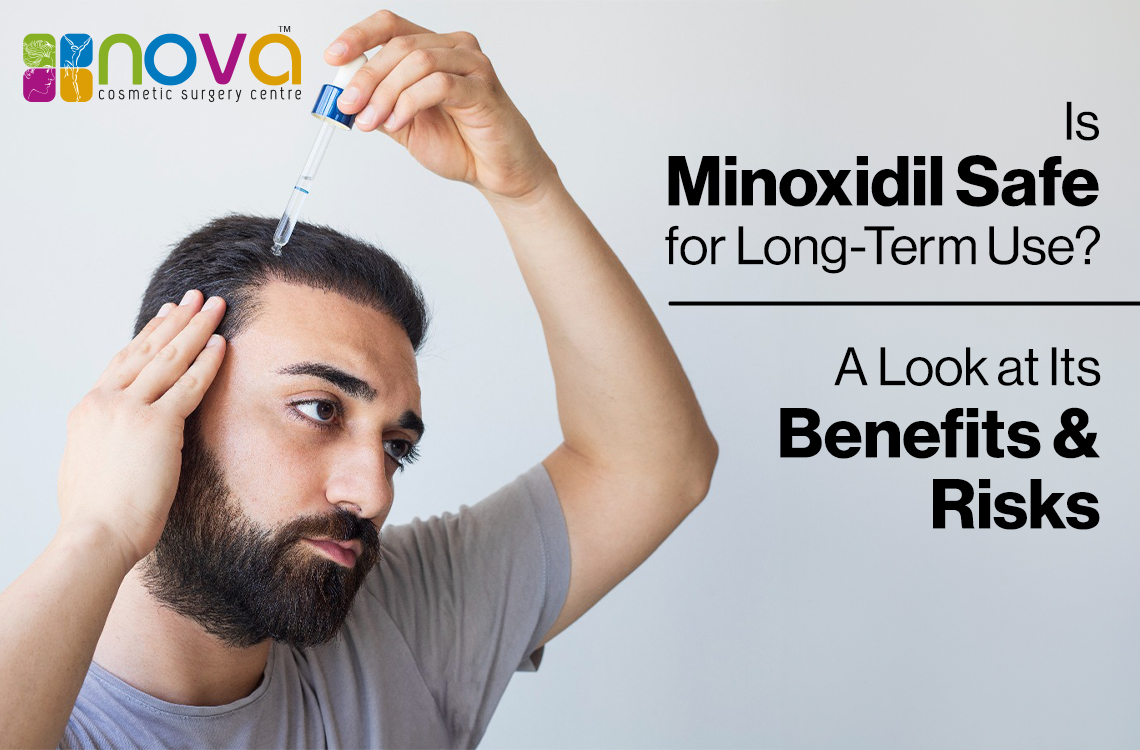 Is Minoxidil Safe for Long-Term Use? A Look at Its Benefits and Risks