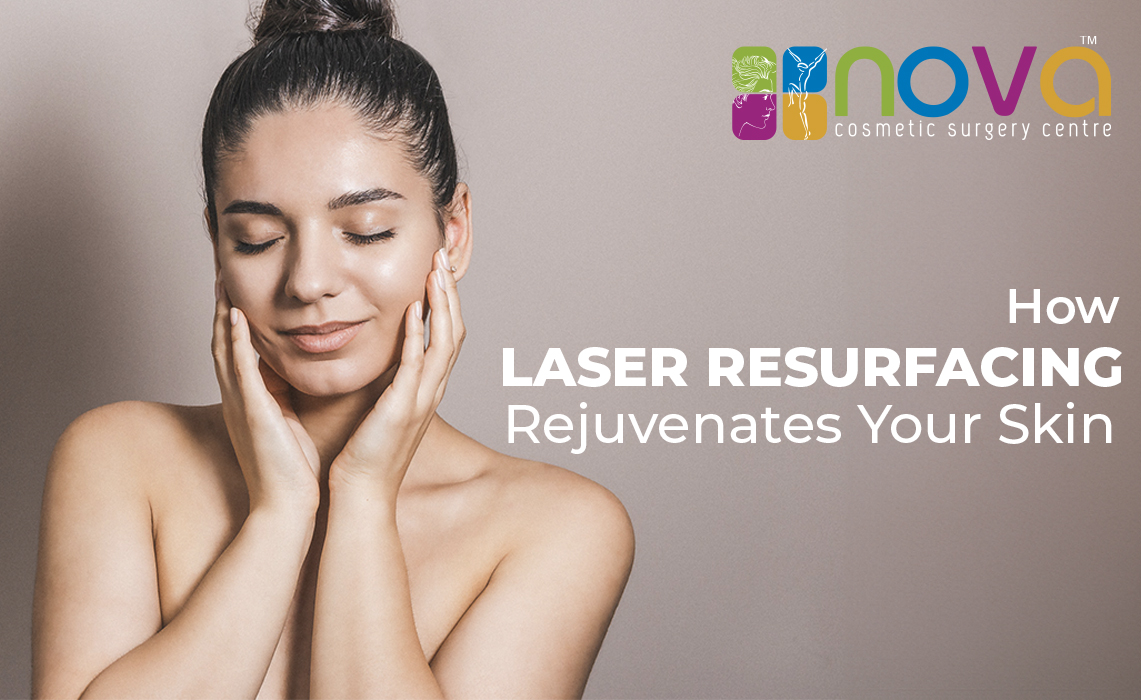 Erase and Renew: How Laser Resurfacing Rejuvenates Your Skin