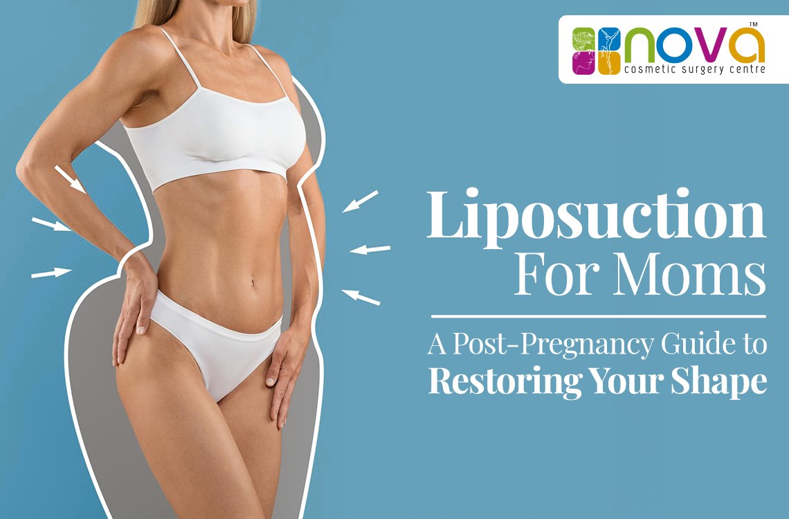 Liposuction for Moms: A Post-Pregnancy Guide to Restoring Your Shape