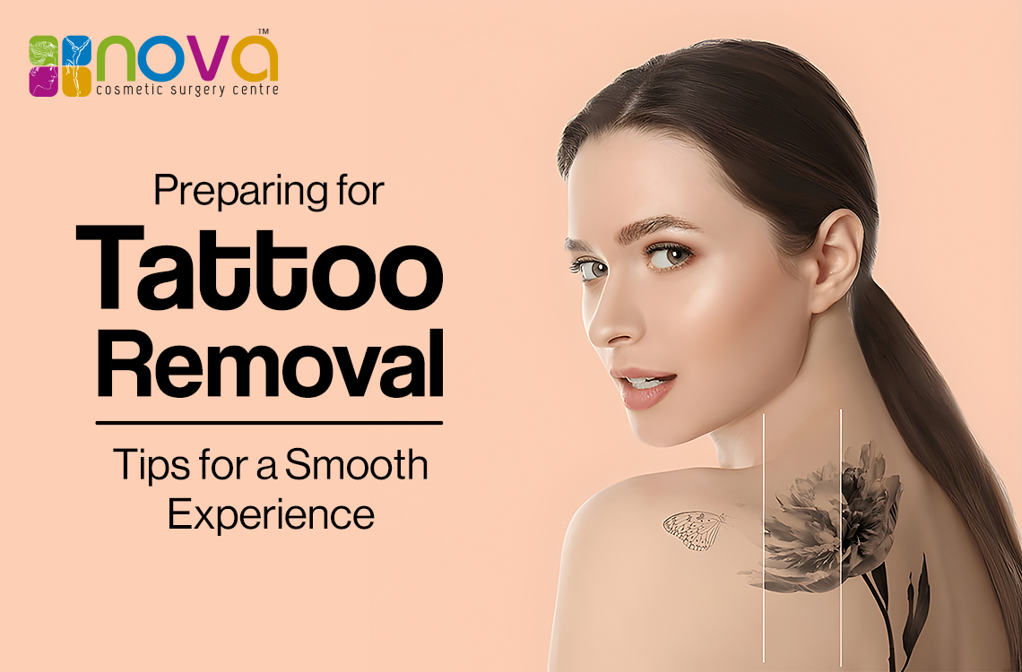 Preparing for Tattoo Removal: Tips for a Smooth Experience