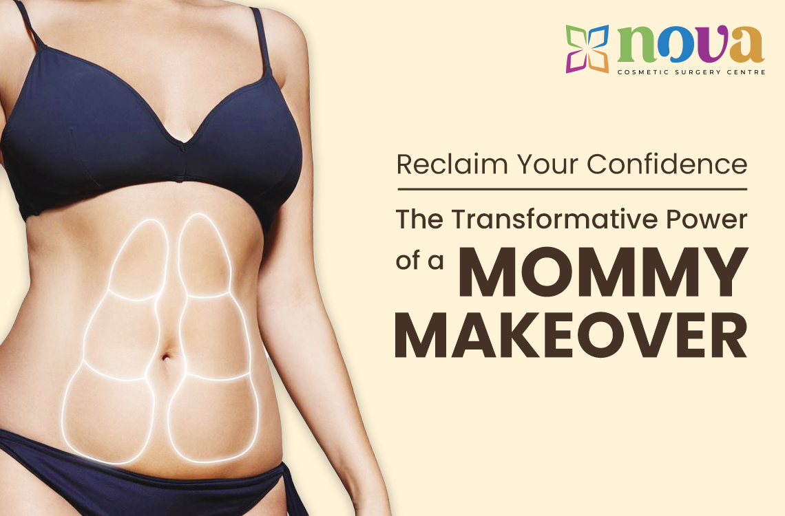 Reclaim Your Confidence: The Transformative Power of a Mommy Makeover