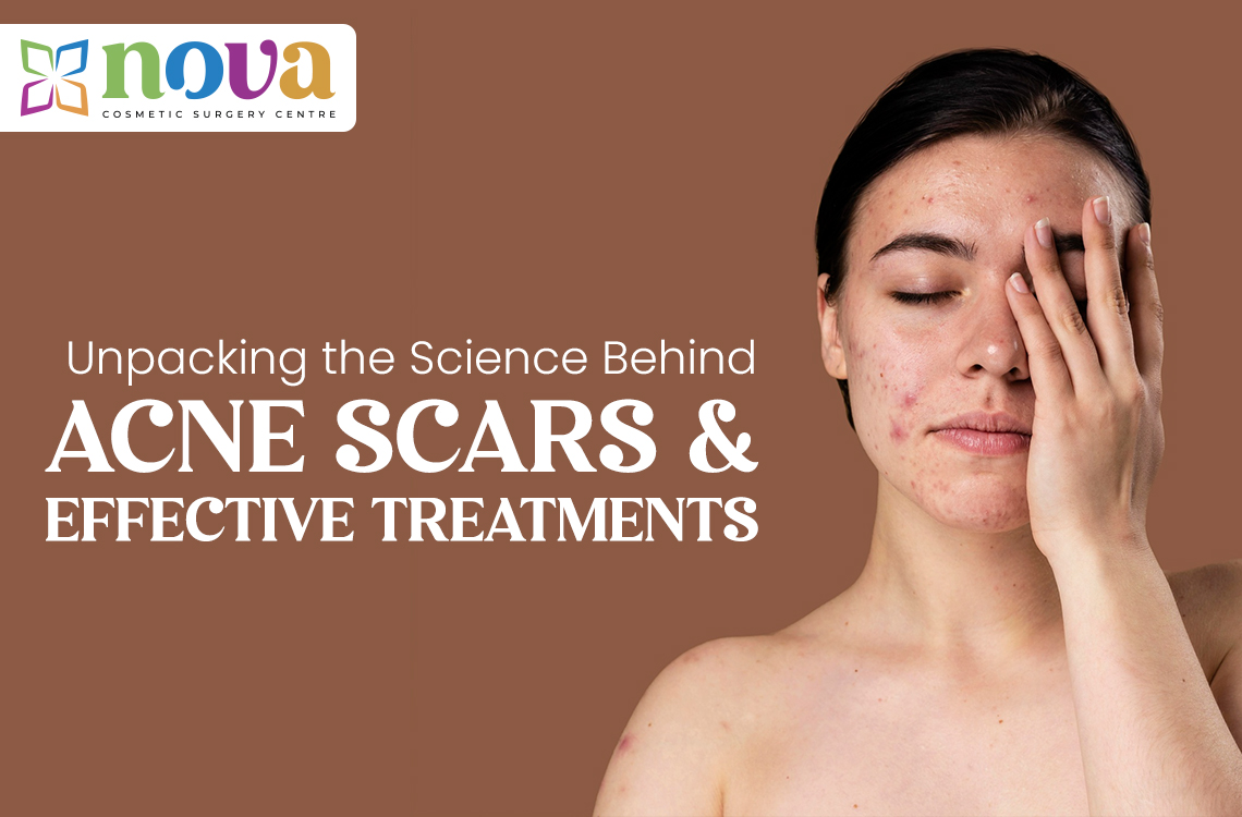 Unpacking the Science Behind Acne Scars and Effective Treatments