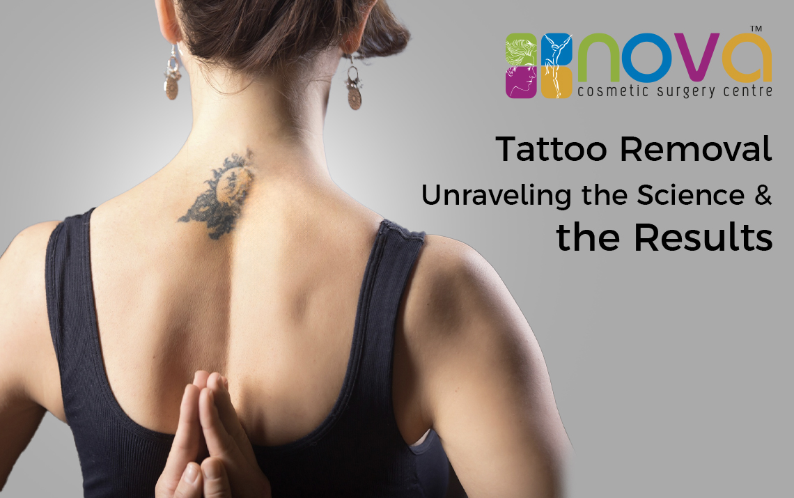 How can a healthy lifestyle speed up your tattoo removal?