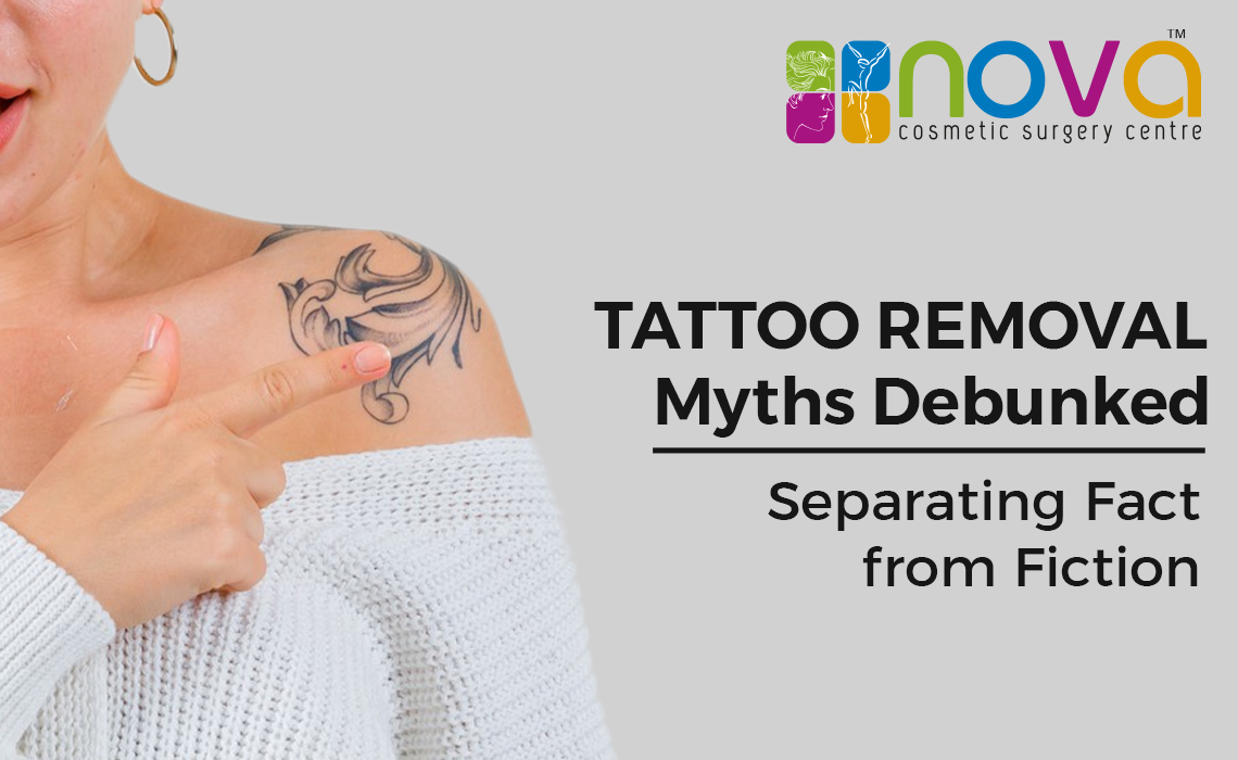 Tattoo Removal Myths Debunked: Separating Fact from Fiction