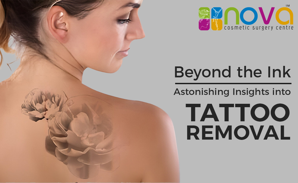 Beyond the Ink: Astonishing Insights into Tattoo Removal