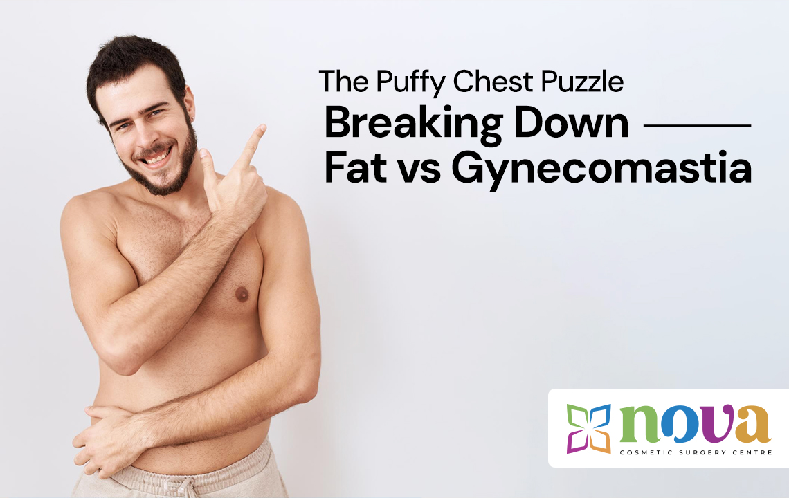 The Puffy Chest Puzzle: Breaking Down Fat vs Gynecomastia