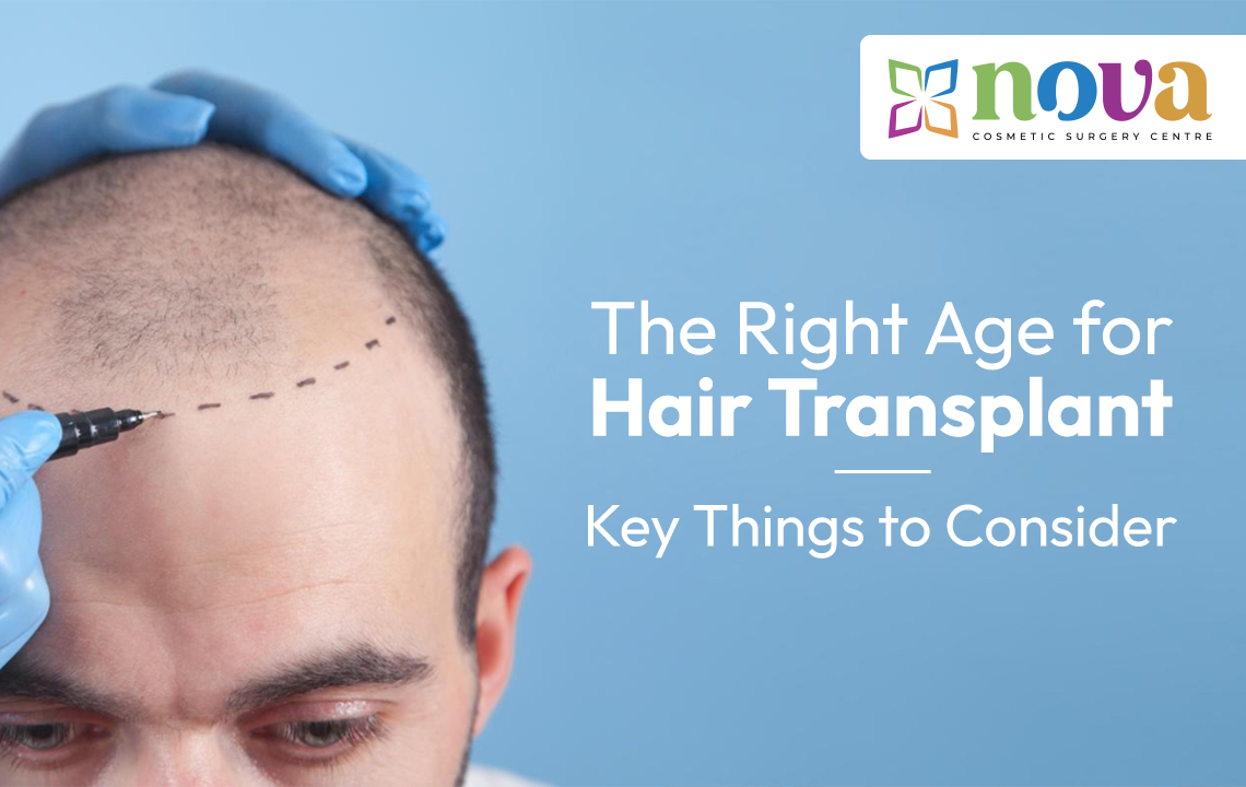 The Right Age for Hair Transplant: Key Things to Consider