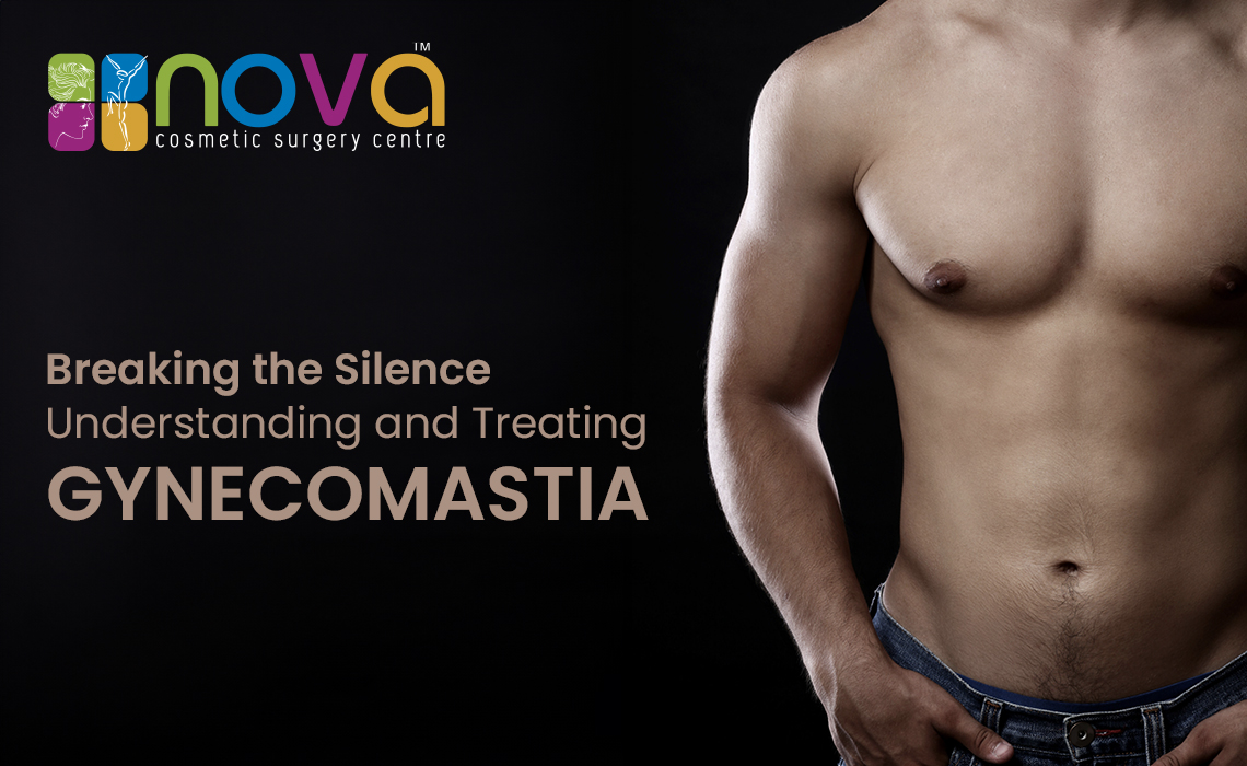 Breaking the Silence: Understanding and Treating Gynecomastia