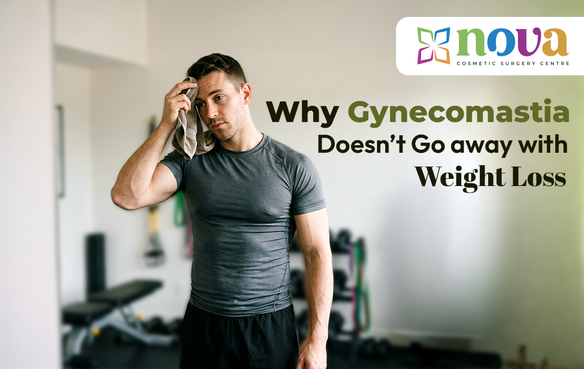Why Gynecomastia Doesn’t Go Away With Weight Loss